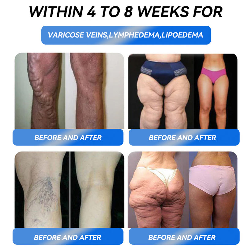 Honxi® GLP-1 Max Weight Loss Oral Solution ✅One dose a day — see results in 7 days👩⚕️Suitable for obesity, cardiovascular diseases, diabetes, sleep apnea, high cholesterol and blood lipids, joint problems, and various other conditions🚀