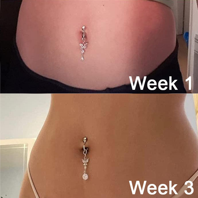 Official Store | Disyan® GLP-1 Lymphvity Nano Microneedle Therapy Belly Button Ring(Pain-free non-piercing design)with Collagen & Matrixyl 3000 丨Obesity,Cardiovascular Diseas, Diabetes, Sleep Apnea, Joint Problems and More