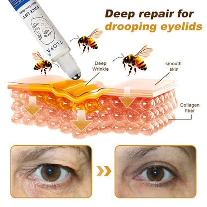 𝐓𝐋𝐎𝐏𝐀® 𝐅𝐀𝐂𝐄 𝐋𝐈𝐅𝐓 𝐒𝐤𝐢𝐧 𝐂𝐚𝐫𝐞 𝐒𝐭𝐢𝐜𝐤 𝐂𝐥𝐢𝐧𝐢𝐜𝐚𝐥𝐥𝐲 𝐏𝐫𝐨𝐯𝐞𝐧 𝐅𝐨𝐫𝐦𝐮𝐥𝐚 | 𝐑𝐞𝐝𝐮𝐜𝐞𝐬 𝐖𝐫𝐢𝐧𝐤𝐥𝐞𝐬 & 𝐅𝐢𝐫𝐦𝐬 𝐒𝐤𝐢𝐧