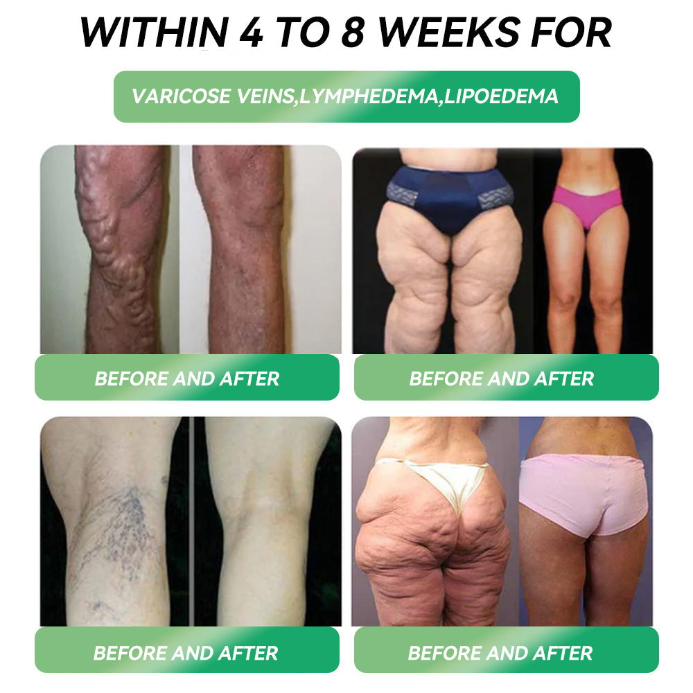 𝐂𝐑𝐎𝐀𝐈𝐄® 𝐆𝐋𝐏-𝟏 𝐒𝐥𝐢𝐦𝐦𝐢𝐧𝐠 & 𝐇𝐞𝐚𝐥𝐭𝐡 𝐔𝐥𝐭𝐫𝐚 𝐂𝐨𝐧𝐜𝐞𝐧𝐭𝐫𝐚𝐭𝐞𝐝 𝐄𝐬𝐬𝐞𝐧𝐜𝐞 𝐋𝐢𝐪𝐮𝐢𝐝 𝐁𝐞𝐚𝐝𝐬🌿-𝐍𝐀𝐃+&𝐌𝐨𝐫𝐢𝐧𝐠𝐚 & 𝐀𝐂𝐕 & 𝐊𝐞𝐭𝐨 𝐁𝐇𝐁(✅𝐬𝐩𝐞𝐞𝐝𝐲, 𝐥𝐨𝐧𝐠-𝐥𝐚𝐬𝐭𝐢𝐧𝐠, 𝐚𝐝𝐝𝐫𝐞𝐬𝐬𝐢𝐧𝐠 𝐝𝐢𝐚𝐛𝐞𝐭𝐞𝐬, 𝐨𝐛𝐞𝐬𝐢𝐭𝐲, 𝐚𝐧𝐝 𝐜𝐚𝐫𝐝𝐢𝐨𝐯𝐚𝐬𝐜𝐮𝐥𝐚𝐫 𝐝𝐢𝐬𝐞𝐚𝐬𝐞𝐬) ✅