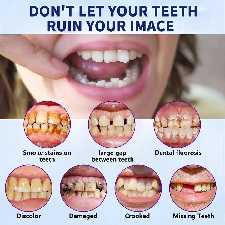 Hermsa®-🦷Advanced Customized Full Denture Set🦷 (⏰Limited time discount last 30 minutes⏰)