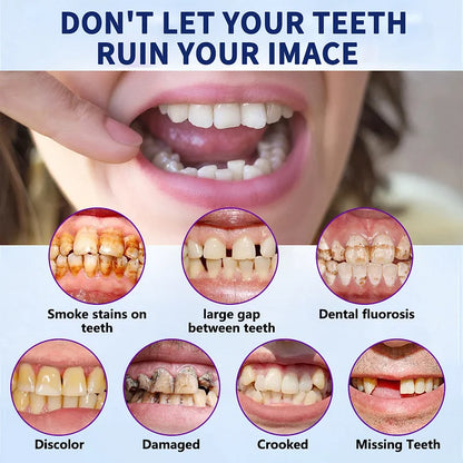 Hermsa®-🦷Advanced Customized Full Denture Set🦷 (⏰Limited time discount last 30 minutes⏰)