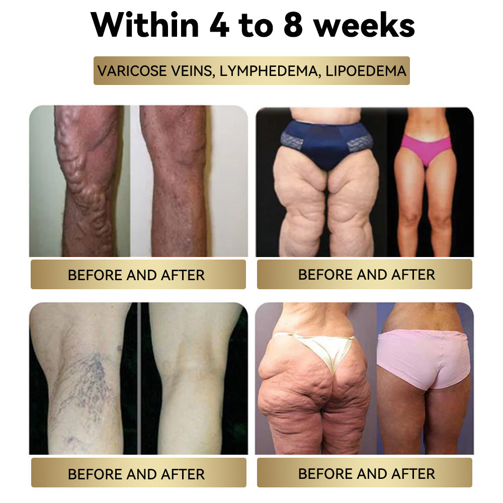 Croaie® NIDDK Tirzepatide Cyclic Peptide Thermo Slim Cream
