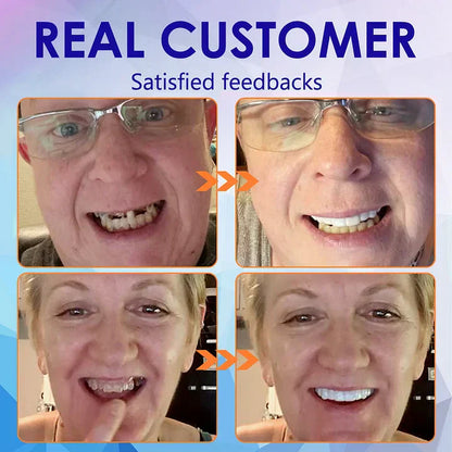 Hermsa®-🦷Advanced Customized Full Denture Set🦷 (⏰Limited time discount last 30 minutes⏰)