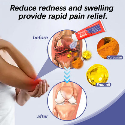 Official Store | Raindew® Turmeric & Emu Oil Arthritis Soothing Pain Relief Massage Gel