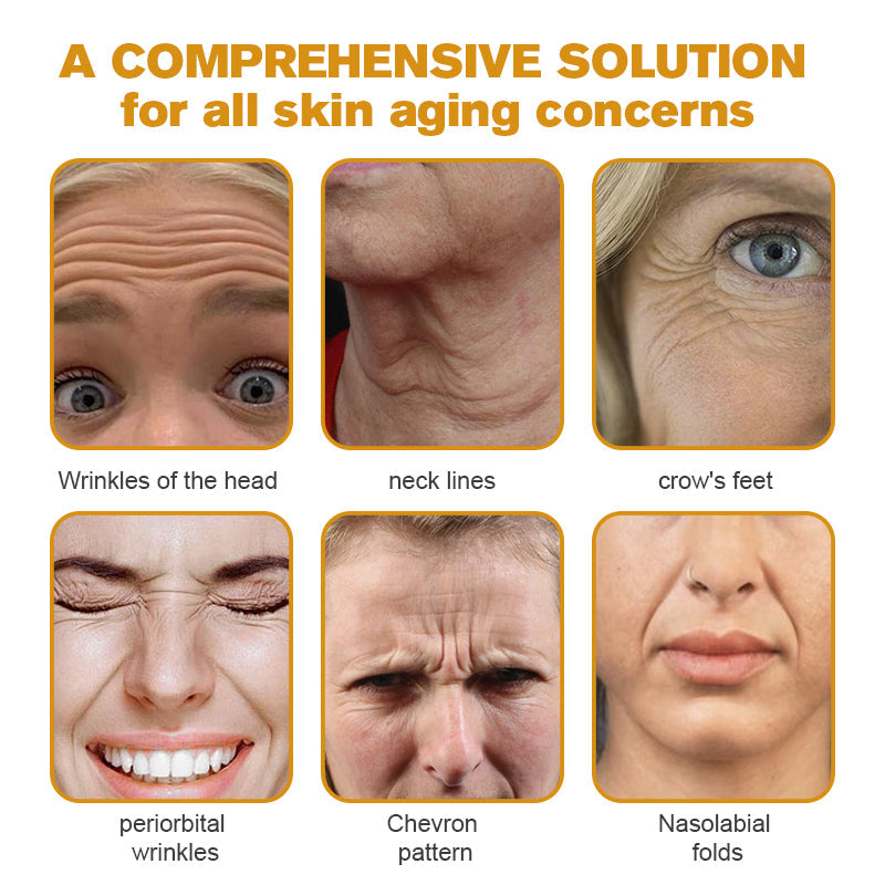 𝐓𝐋𝐎𝐏𝐀® 𝐅𝐀𝐂𝐄 𝐋𝐈𝐅𝐓 𝐒𝐤𝐢𝐧 𝐂𝐚𝐫𝐞 𝐒𝐭𝐢𝐜𝐤 𝐂𝐥𝐢𝐧𝐢𝐜𝐚𝐥𝐥𝐲 𝐏𝐫𝐨𝐯𝐞𝐧 𝐅𝐨𝐫𝐦𝐮𝐥𝐚 | 𝐑𝐞𝐝𝐮𝐜𝐞𝐬 𝐖𝐫𝐢𝐧𝐤𝐥𝐞𝐬 & 𝐅𝐢𝐫𝐦𝐬 𝐒𝐤𝐢𝐧