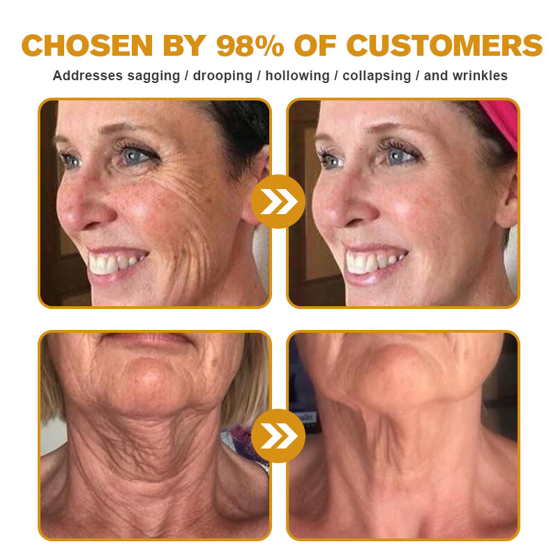 𝐓𝐋𝐎𝐏𝐀® 𝐅𝐀𝐂𝐄 𝐋𝐈𝐅𝐓 𝐒𝐤𝐢𝐧 𝐂𝐚𝐫𝐞 𝐒𝐭𝐢𝐜𝐤 𝐂𝐥𝐢𝐧𝐢𝐜𝐚𝐥𝐥𝐲 𝐏𝐫𝐨𝐯𝐞𝐧 𝐅𝐨𝐫𝐦𝐮𝐥𝐚 | 𝐑𝐞𝐝𝐮𝐜𝐞𝐬 𝐖𝐫𝐢𝐧𝐤𝐥𝐞𝐬 & 𝐅𝐢𝐫𝐦𝐬 𝐒𝐤𝐢𝐧