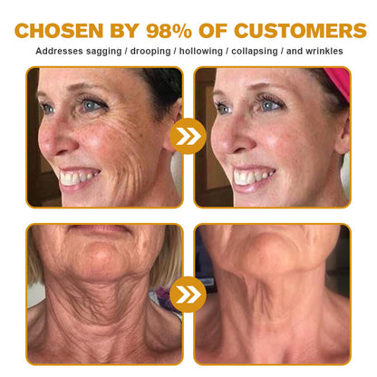 𝐓𝐋𝐎𝐏𝐀® 𝐅𝐀𝐂𝐄 𝐋𝐈𝐅𝐓 𝐒𝐤𝐢𝐧 𝐂𝐚𝐫𝐞 𝐒𝐭𝐢𝐜𝐤 𝐂𝐥𝐢𝐧𝐢𝐜𝐚𝐥𝐥𝐲 𝐏𝐫𝐨𝐯𝐞𝐧 𝐅𝐨𝐫𝐦𝐮𝐥𝐚 | 𝐑𝐞𝐝𝐮𝐜𝐞𝐬 𝐖𝐫𝐢𝐧𝐤𝐥𝐞𝐬 & 𝐅𝐢𝐫𝐦𝐬 𝐒𝐤𝐢𝐧