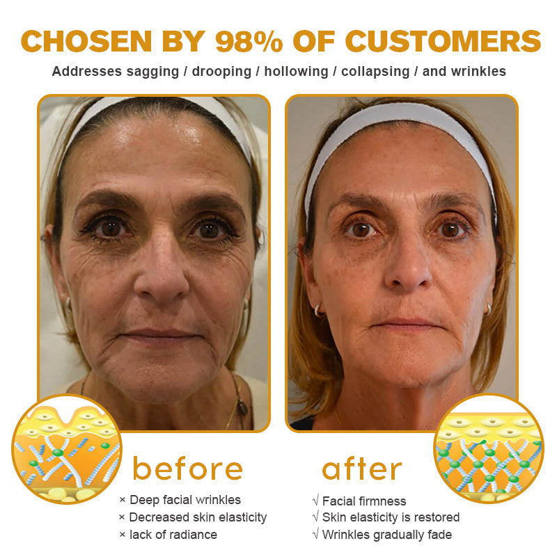 Coolord®🌸 perfect eye tightener – New Formula, Ultimate Lift & Smooth Finish ✨