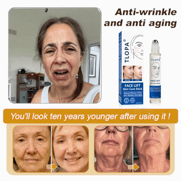 𝐓𝐋𝐎𝐏𝐀® 𝐅𝐀𝐂𝐄 𝐋𝐈𝐅𝐓 𝐒𝐤𝐢𝐧 𝐂𝐚𝐫𝐞 𝐒𝐭𝐢𝐜𝐤 𝐂𝐥𝐢𝐧𝐢𝐜𝐚𝐥𝐥𝐲 𝐏𝐫𝐨𝐯𝐞𝐧 𝐅𝐨𝐫𝐦𝐮𝐥𝐚 | 𝐑𝐞𝐝𝐮𝐜𝐞𝐬 𝐖𝐫𝐢𝐧𝐤𝐥𝐞𝐬 & 𝐅𝐢𝐫𝐦𝐬 𝐒𝐤𝐢𝐧