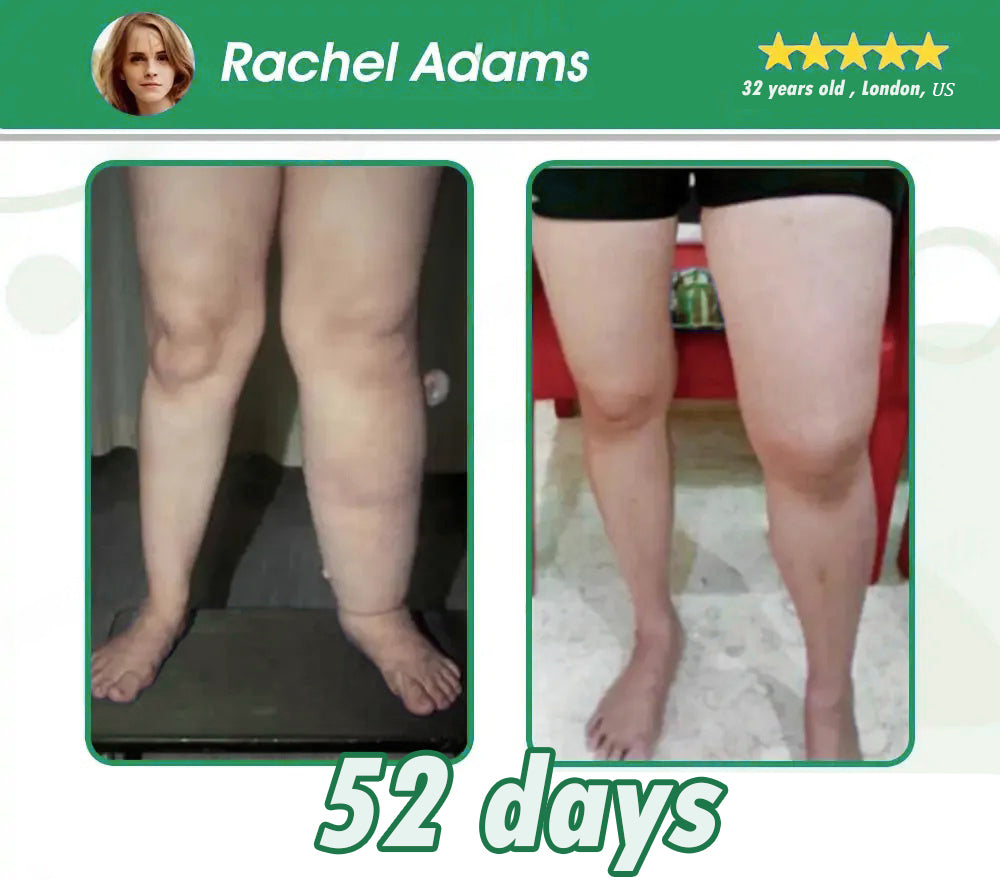 𝐂𝐑𝐎𝐀𝐈𝐄® 𝐆𝐋𝐏-𝟏 𝐒𝐥𝐢𝐦𝐦𝐢𝐧𝐠 & 𝐇𝐞𝐚𝐥𝐭𝐡 𝐔𝐥𝐭𝐫𝐚 𝐂𝐨𝐧𝐜𝐞𝐧𝐭𝐫𝐚𝐭𝐞𝐝 𝐄𝐬𝐬𝐞𝐧𝐜𝐞 𝐋𝐢𝐪𝐮𝐢𝐝 𝐁𝐞𝐚𝐝𝐬🌿-𝐍𝐀𝐃+&𝐌𝐨𝐫𝐢𝐧𝐠𝐚 & 𝐀𝐂𝐕 & 𝐊𝐞𝐭𝐨 𝐁𝐇𝐁(✅𝐬𝐩𝐞𝐞𝐝𝐲, 𝐥𝐨𝐧𝐠-𝐥𝐚𝐬𝐭𝐢𝐧𝐠, 𝐚𝐝𝐝𝐫𝐞𝐬𝐬𝐢𝐧𝐠 𝐝𝐢𝐚𝐛𝐞𝐭𝐞𝐬, 𝐨𝐛𝐞𝐬𝐢𝐭𝐲, 𝐚𝐧𝐝 𝐜𝐚𝐫𝐝𝐢𝐨𝐯𝐚𝐬𝐜𝐮𝐥𝐚𝐫 𝐝𝐢𝐬𝐞𝐚𝐬𝐞𝐬) ✅