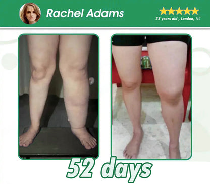 𝐂𝐑𝐎𝐀𝐈𝐄® 𝐆𝐋𝐏-𝟏 𝐒𝐥𝐢𝐦𝐦𝐢𝐧𝐠 & 𝐇𝐞𝐚𝐥𝐭𝐡 𝐔𝐥𝐭𝐫𝐚 𝐂𝐨𝐧𝐜𝐞𝐧𝐭𝐫𝐚𝐭𝐞𝐝 𝐄𝐬𝐬𝐞𝐧𝐜𝐞 𝐋𝐢𝐪𝐮𝐢𝐝 𝐁𝐞𝐚𝐝𝐬🌿-𝐍𝐀𝐃+&𝐌𝐨𝐫𝐢𝐧𝐠𝐚 & 𝐀𝐂𝐕 & 𝐊𝐞𝐭𝐨 𝐁𝐇𝐁(✅𝐬𝐩𝐞𝐞𝐝𝐲, 𝐥𝐨𝐧𝐠-𝐥𝐚𝐬𝐭𝐢𝐧𝐠, 𝐚𝐝𝐝𝐫𝐞𝐬𝐬𝐢𝐧𝐠 𝐝𝐢𝐚𝐛𝐞𝐭𝐞𝐬, 𝐨𝐛𝐞𝐬𝐢𝐭𝐲, 𝐚𝐧𝐝 𝐜𝐚𝐫𝐝𝐢𝐨𝐯𝐚𝐬𝐜𝐮𝐥𝐚𝐫 𝐝𝐢𝐬𝐞𝐚𝐬𝐞𝐬) ✅